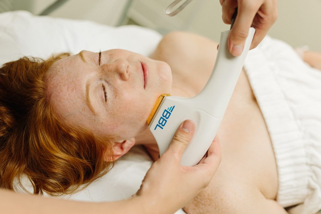 young woman receiving a laser treatment on her face